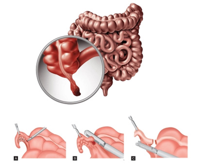 serum creatinine