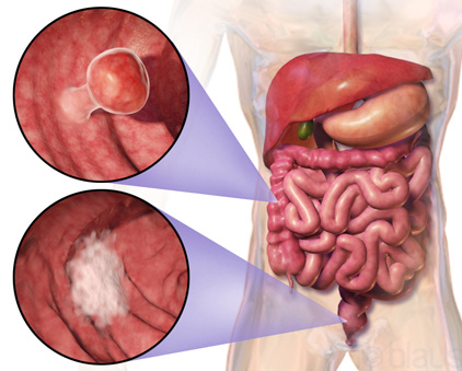 serum creatinine